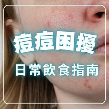 長痘痘要吃什麼？補對營養＋避開地雷食物，緩解膚況焦慮