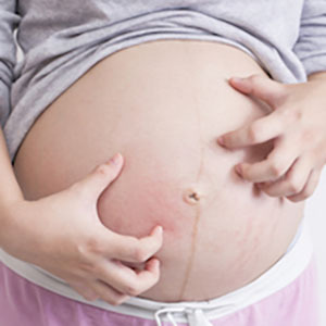 懷孕起疹子發癢，吃什麼解胎毒？清胎毒食物大全