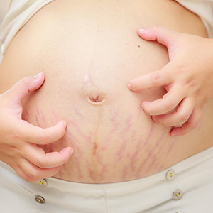 懷孕為什麼會皮膚癢？孕期緩解、預防皮膚癢推薦6招！