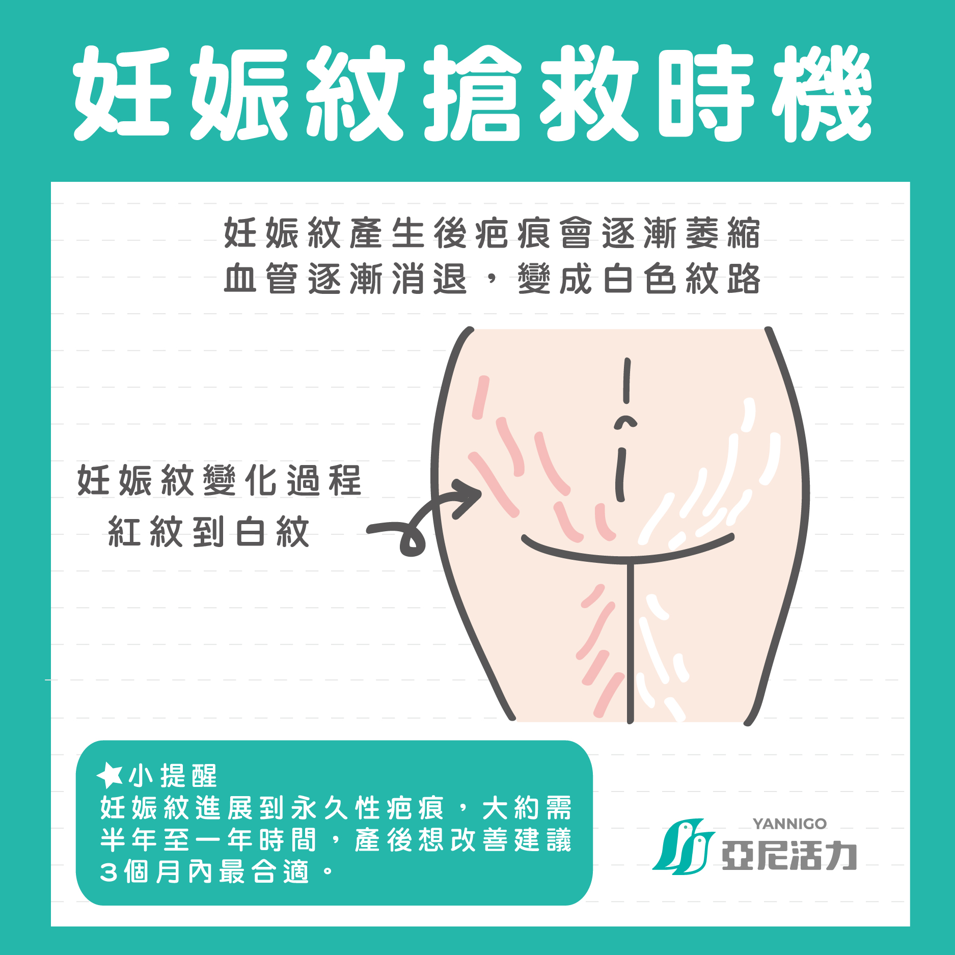 別留下懷孕妊娠紋 搶救 這個時機 消除妊娠紋最有效 亞尼活力