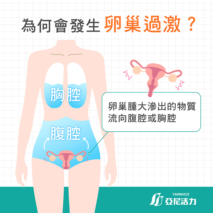 卵巢過激症候群發生原因