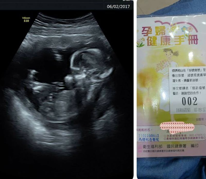 我懷孕了