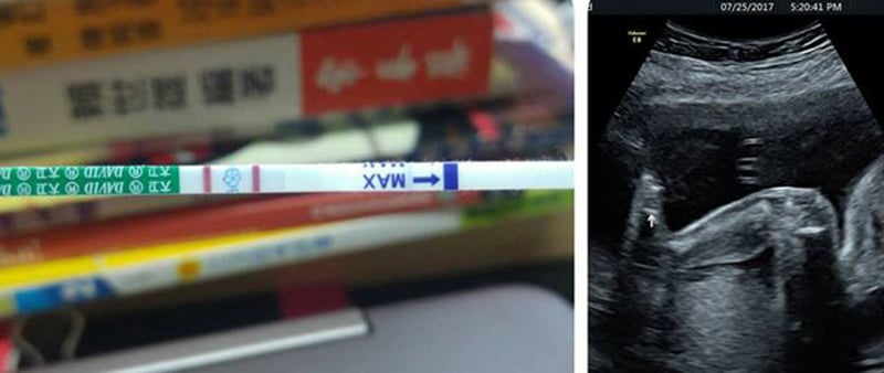 懷孕開獎