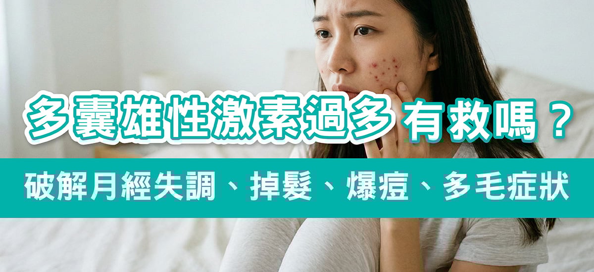 Dcard熱議【雄性激素過高有救嗎?】破解多囊常見的月經失調、掉髮、爆痘多毛症狀 Dcard熱議【雄性激素過高有救嗎?】破解多囊常見的月經失調、掉髮、爆痘多毛症狀