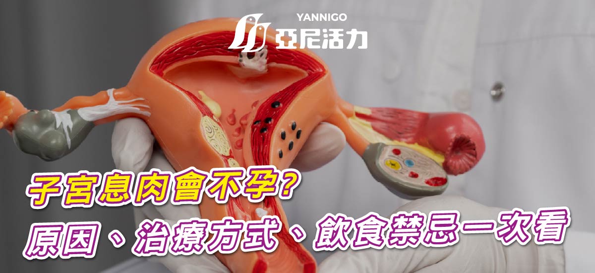 子宮息肉會影響懷孕?症狀、原因與治療方式一次看 子宮息肉會影響懷孕?症狀、原因與治療方式一次看
