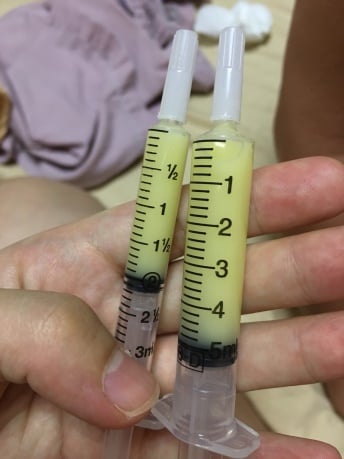 產後初乳
