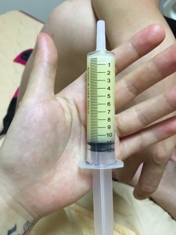 針筒集初乳