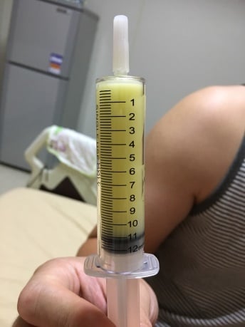 產後黃金初乳卵磷脂