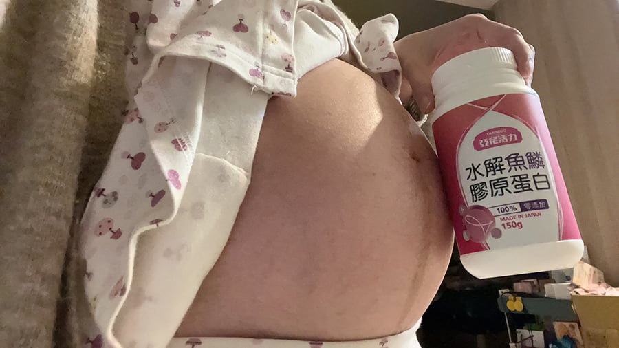 亞尼活力膠原蛋白孕婦保養孕肚必備