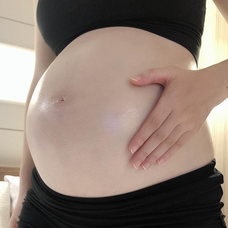 孕期保養打擊妊娠紋