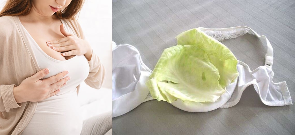 Nursing Cabbage Cold Compress