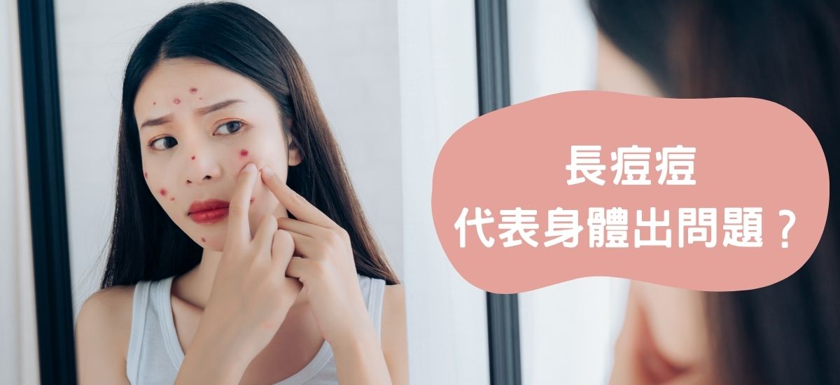 (痘痘位置圖解)長痘痘是哪裡出問題？