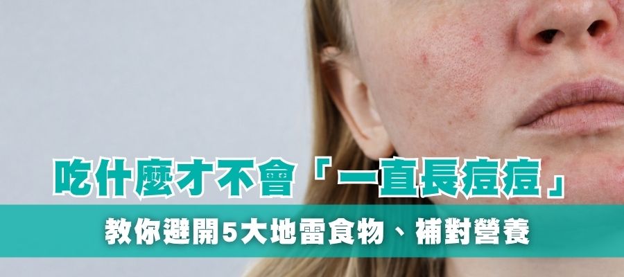 長痘痘要吃什麼?補對營養+避開地雷食物,緩解膚況焦慮 長痘痘要吃什麼?補對營養+避開地雷食物,緩解膚況焦慮