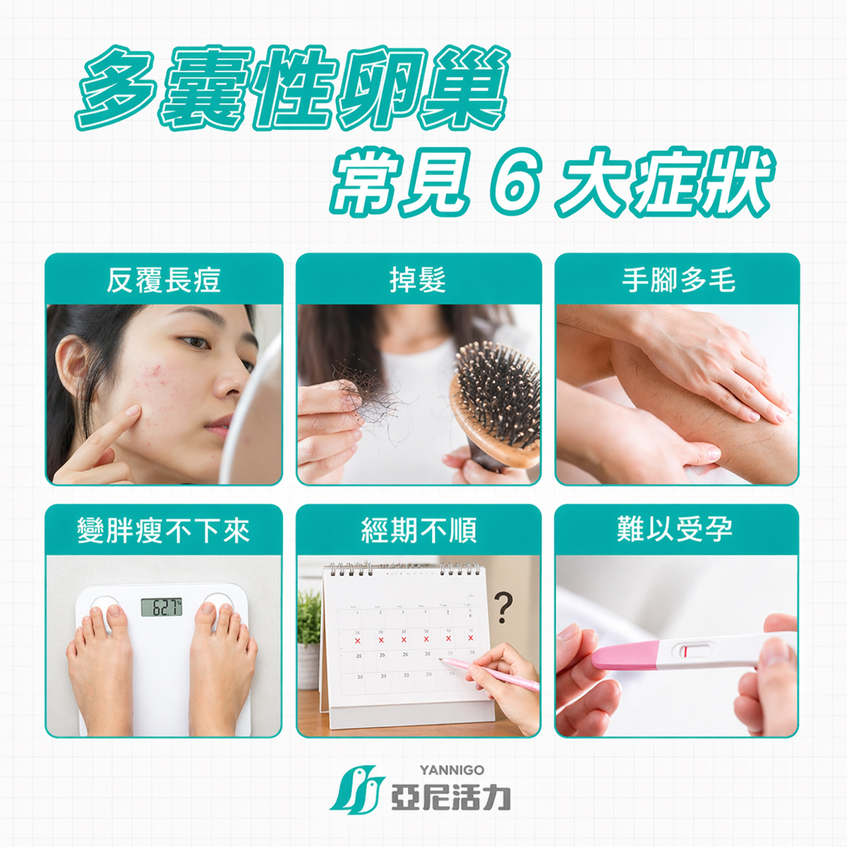 形容多囊性卵巢症候群常見6大症狀