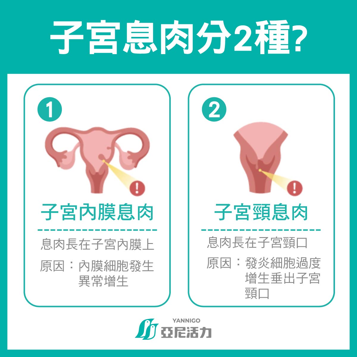 子宮息肉是什麼 子宮息肉是什麼